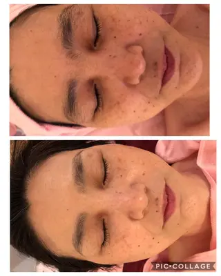 y.laBelle 艶肌・小顔・肌質改善のエステ・リラクイメージ