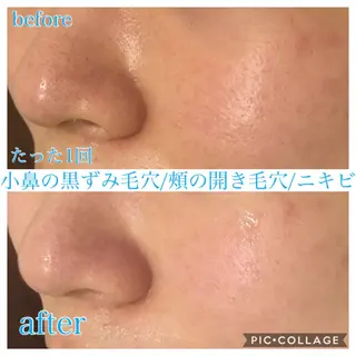 ロング カラー パーマ ヘアアレンジ キッズ ネイル マツエク・マツパ EnsorClair 代表 野口真央のエステ・リラクイメージ