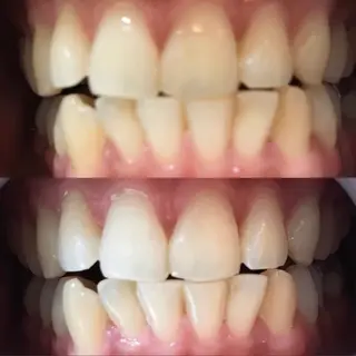 LBSホワイトニング 🌐 上野店公式のエステ・リラクイメージ