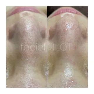 Sugaring / HILOT TAOのエステ・リラクイメージ