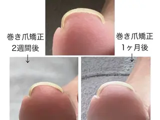 ネイル プライベートサロン アオラのネイルデザイン