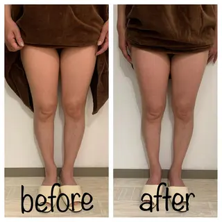 リンパマッサージ mimozaのエステ・リラクイメージ