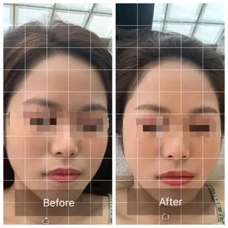 うめきた鍼灸院 SENSEのエステ・リラクイメージ
