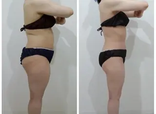 秒速小顔 新宿店所属・秒速小顔 新宿店 さきのエステ・リラクイメージ