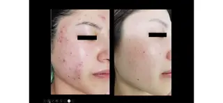 肌の質を変えるエステ 🤍🫧Nanaのエステ・リラクイメージ