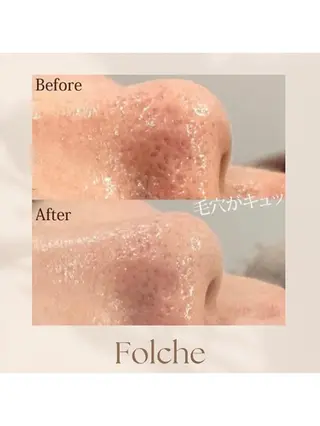 菊地 そらのエステ・リラクイメージ