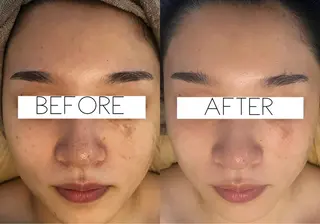 小顔&美肌品川店 Masqueradeのエステ・リラクイメージ