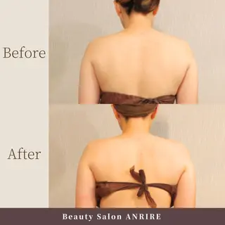 ANRIRE (アンリール)のエステ・リラクイメージ