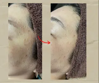 代表 MOMOのエステ・リラクイメージ