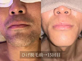 脱毛サロン Arumのエステ・リラクイメージ