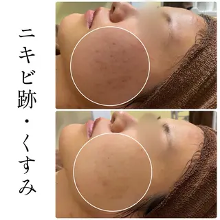 ハーブピーリング専門 BIOEL横浜のエステ・リラクイメージ