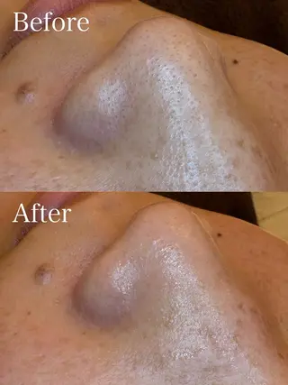 🤍アベシュリ /フェイシャル🤍のエステ・リラクイメージ