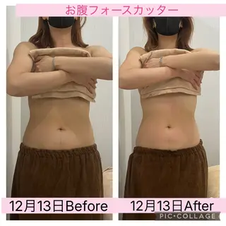 ブライダル痩身×脱毛 尼崎駅前サロンのエステ・リラクイメージ