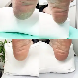 巻き爪補正店 大阪なんば店のネイルデザイン