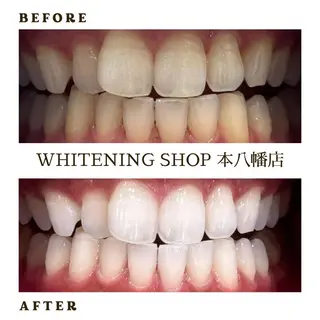 メンズ ホワイトニング ショップ本八幡店のエステ・リラクイメージ