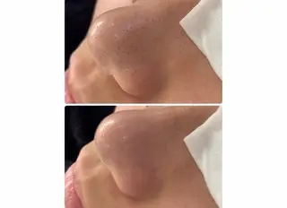 菊池 歩美のマツエク・マツパデザイン