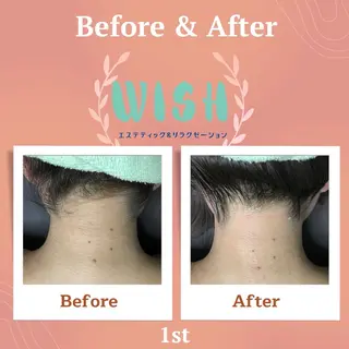 WISH リラク×エステ 須藤のエステ・リラクイメージ