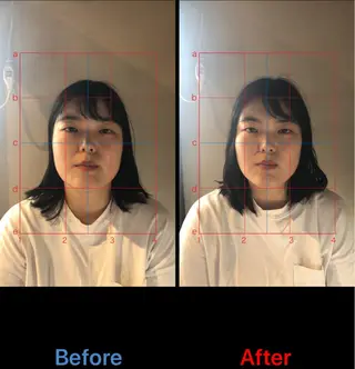 美容鍼専門 ハリエンジュのエステ・リラクイメージ