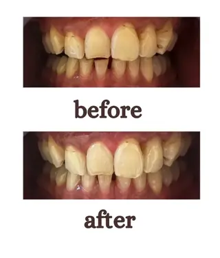 Nailbeauty marcherのネイルデザイン