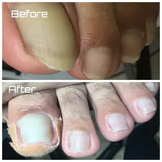 メンズ ネイル ドクターネイル爪革命 takahashiのその他イメージ