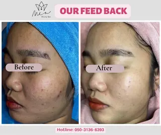 MiA Beautyのエステ・リラクイメージ