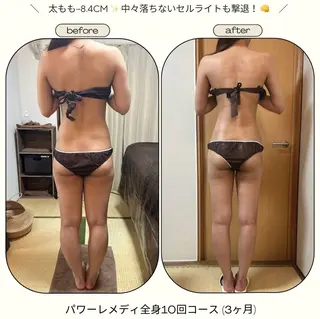 《本気痩せ×疲労改善 》  BILOOPのエステ・リラクイメージ