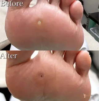 福岡巻き爪補正店 博多店のエステ・リラクイメージ