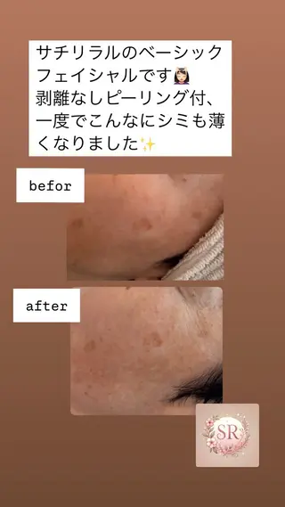 Sachi Riraruのエステ・リラクイメージ