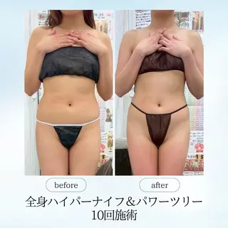 《痩身、小顔専門店》 エスプレッソのエステ・リラクイメージ