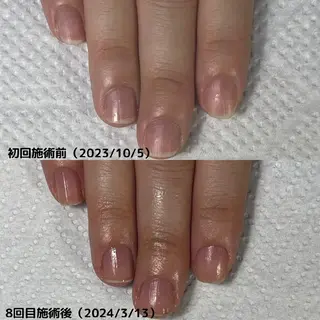 ネイル nail 1623のネイルデザイン