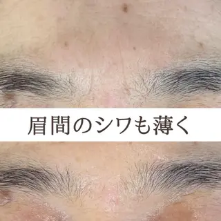 都度払い 肌質改善専門サロンのエステ・リラクイメージ