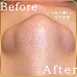 アイスリーサロン所属・毛穴改善サロン アイスリーのエステ・リラクイメージ