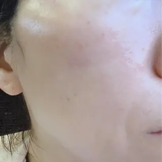 メナードグレスハート 木村直子のエステ・リラクイメージ