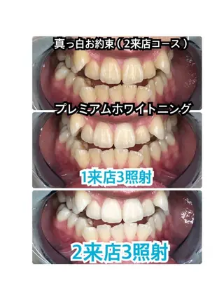 ホワイトニング専門店 吉田亮利のその他イメージ