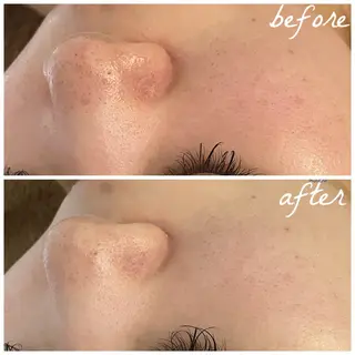 メンズ メナード岐阜茜部 杉浦のエステ・リラクイメージ