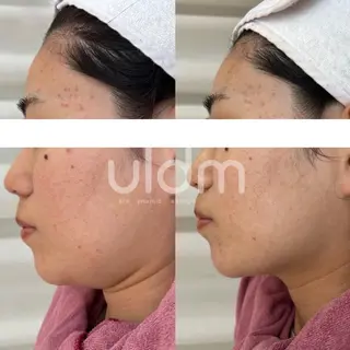 crescent所属・【韓国肌管理・脱毛】 クレセントのその他イメージ