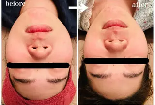 EXTR エクスターのエステ・リラクイメージ