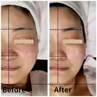 自然派フェイシャル やながわのエステ・リラクイメージ