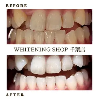 メンズ ホワイトニング ショップ千葉店のその他イメージ