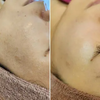 美肌脱毛&毛穴専門 Anaciaのエステ・リラクイメージ