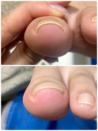 ネイル 自爪育成nail fachuriのネイルデザイン