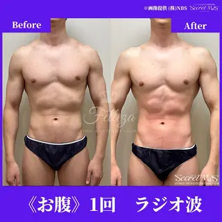 メンズ 有人型セルフサロン 脱毛/痩身/美顔のエステ・リラクイメージ