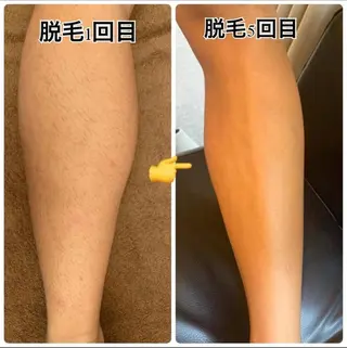 メンズ 東風平 琉登のエステ・リラクイメージ