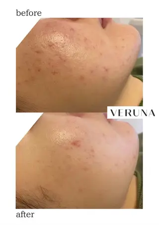 ハーブピーリング専門 グランディール　武内のエステ・リラクイメージ