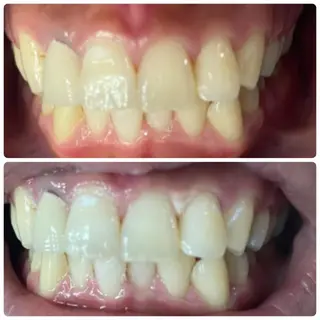 メンズ LOVEホワイト ニング恵比寿店のその他イメージ