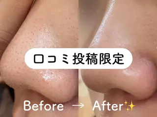 小顔/毛穴/肌質改善 💆セラピエージのエステ・リラクイメージ