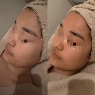 毛穴/くすみ/ シミ/POLAのエステ・リラクイメージ