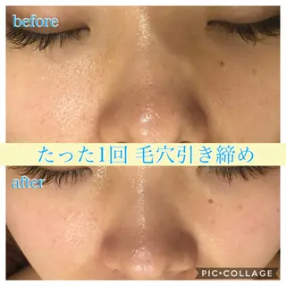 ミディアム カラー パーマ ヘアアレンジ キッズ ネイル マツエク・マツパ EnsorClair 代表 野口真央のエステ・リラクイメージ