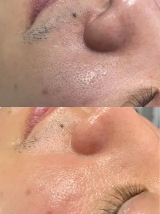 ビューティーサロン Lino🫧mayuのエステ・リラクイメージ