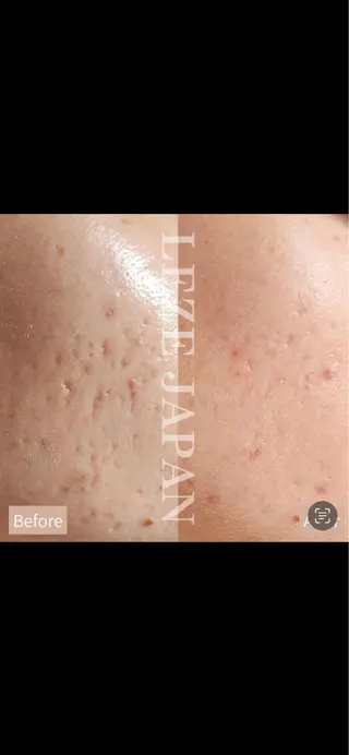 Lilyboo 池袋のエステ・リラクイメージ